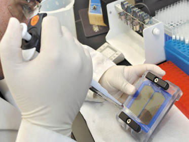 FDA зарегистрировало тест для диагностики инфекции Mycoplasma genitalium, передаваемой половым путем