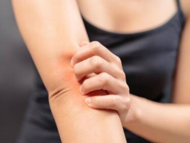 Механізми виникнення свербежу: нові уявлення про взаємозв’язок нервової та імунної систем