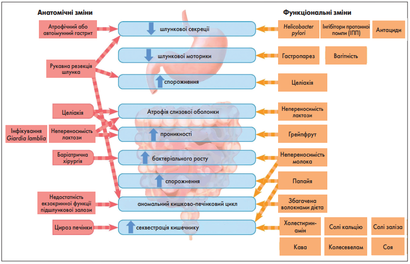 Рис. 2. Анатомічні і функціональні зміни, які можуть зменшувати або сповільнювати всмоктування L-тироксину в ШКТ