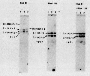 Рис. 2. Поліморфізм генів константних ділянок імуноглобулінів при проведенні гібридизації southern blot у пацієнта з первинним дефіцитом IgG2, IgG4 та IgE (за Ninomiya H. зі співавт.): 1 – людська плацента; 2 – FLEB14-14; 3 – ДНК пацієнта
