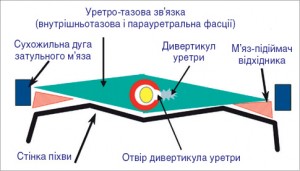 Рис. 7. Схематичне зображення середньої третини уретри на поперечному розрізі: ДУ знаходиться між листками уретро-тазової зв’язки [18]