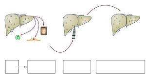 Рисунок 3. Схема основных этапов и критических моментов при клеточной терапии заболеваний печени