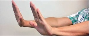 Тест на астериксис (хлопающий тремор): руки разогнуты в локтевых суставах, кисти в дорсифлексии