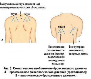 Отношения выдоха к вдоху Отношения выдоха к вдоху