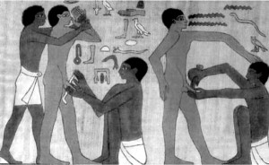 Рис. 1. Операция обрезания, Древний Египет