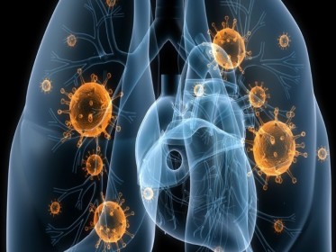 Ефективність і безпека кортикостероїдів при позалікарняній пневмонії: систематичний огляд і метааналіз