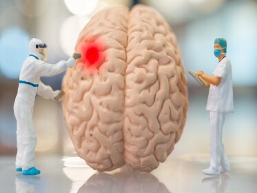 Стандарти надання кваліфікованої медичної допомоги при бойових ураженнях головного мозку