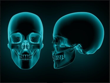 Нещодавно виявлена кісткова стовбурова клітина є причиною передчасного зрощення черепа
