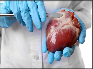 Американські фахівці здійснили другу трансплантацію серця від свині до людини
