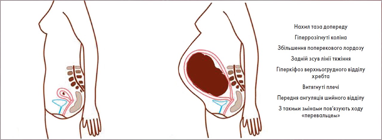 Рис. Загальний ефект вагітності на поставу в останній місяць гестації (порівняно з ранніми термінами)