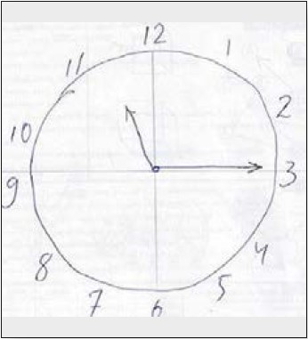 Рисунок 9. Тест малювання годинника пацієнта С.