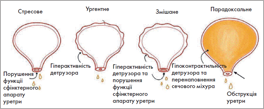 Akysh_4_2024_st25-35_pic4.png