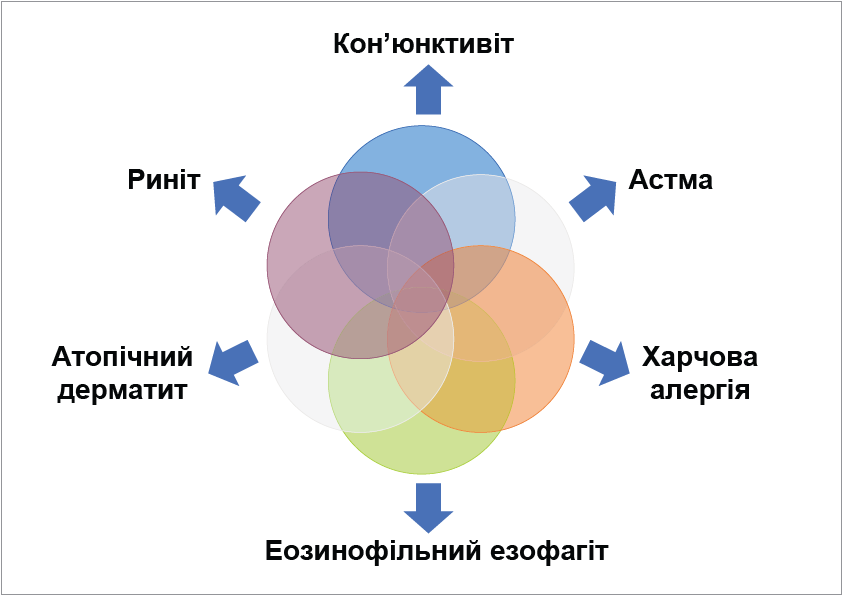 Рис. 1. Алергічні коморбідності (адаптовано за Dupuis P. et al., 2020)