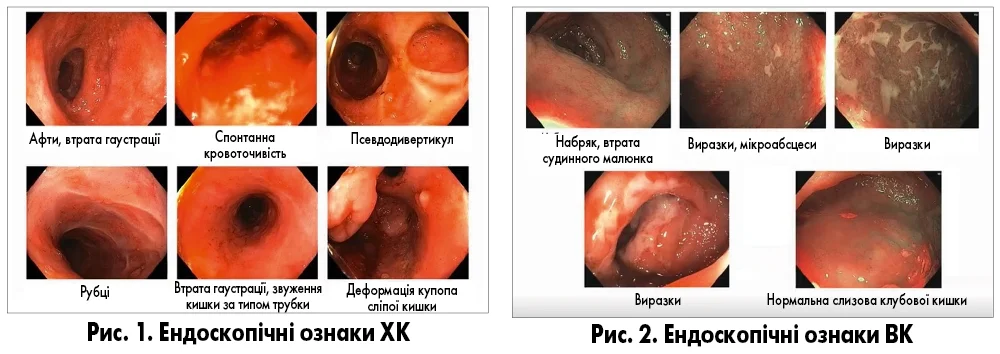 Pediatria_3_2025_ris_1_2_str____1_34.webp