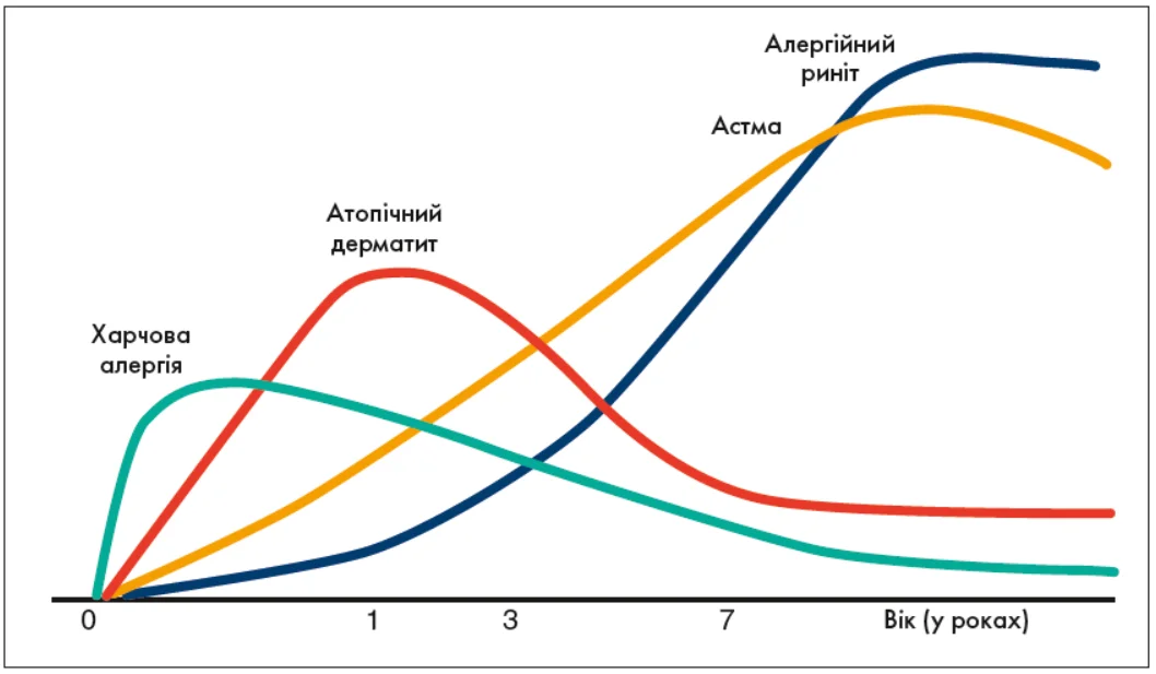 Рис. 2. Класичний варіант атопічного маршу (адаптовано з Belgrave та співавт., 2014) Pulm-_3-4_2025_p_10_pic_2.webp