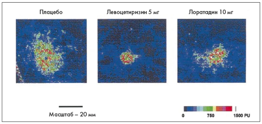 Рис. 4. Скановані лазерні доплерівські зображення, Pulm-_3-4_2025_p_31_pic_4.webp