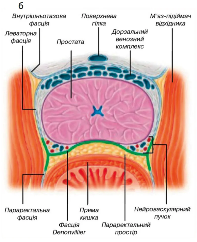 Рис. 4. Анатомічні особливості простати та дорзального венозного комплексу на сагітальному (а) та поперечному (б) розрізах