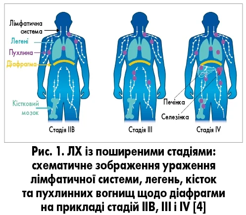 Onco_3_4_2026_ris_1_str_21.webp