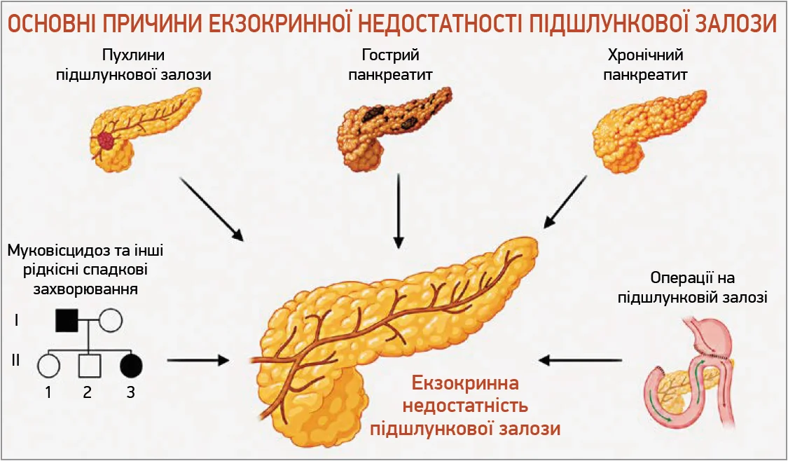 Рис. 1. Основні причини ЕНПЗ Рис. 1. Основні причини ЕНПЗ