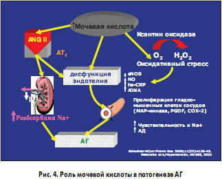 Рис. 4. Роль мочевой кислоты в патогенезе АГ