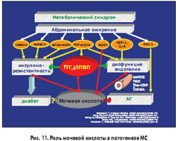 Рис. 11. Роль мочевой кислоты в патогенезе МС
