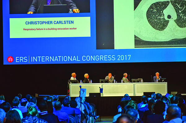 ERS International Congress 2017: обзор главного события европейской пульмонологии