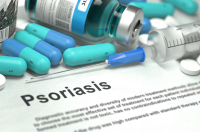 FDA одобрило новый препарат для лечения псориаза