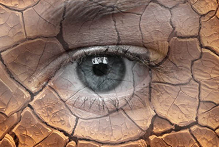 Связь между качеством сна, общим самочувствием и характеристиками поверхности глаза у пациентов с синдромом сухого глаза