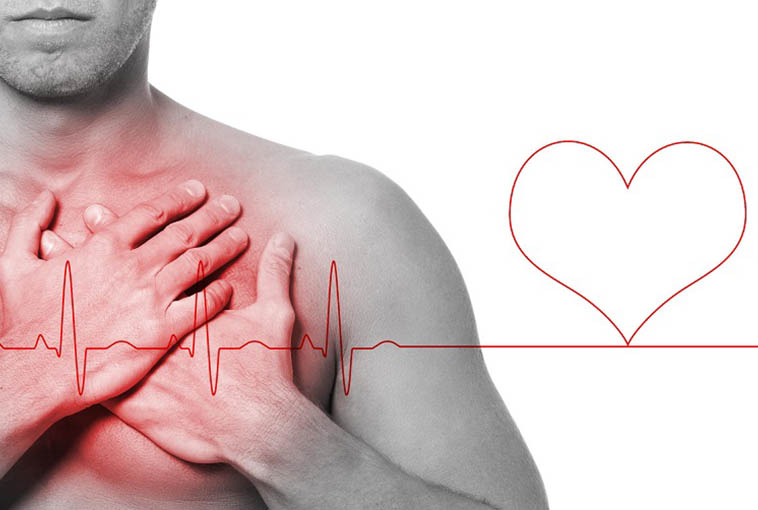 Ингибиторы фосфодиэстеразы приводили к лучшей выживаемости при ишемической болезни сердца