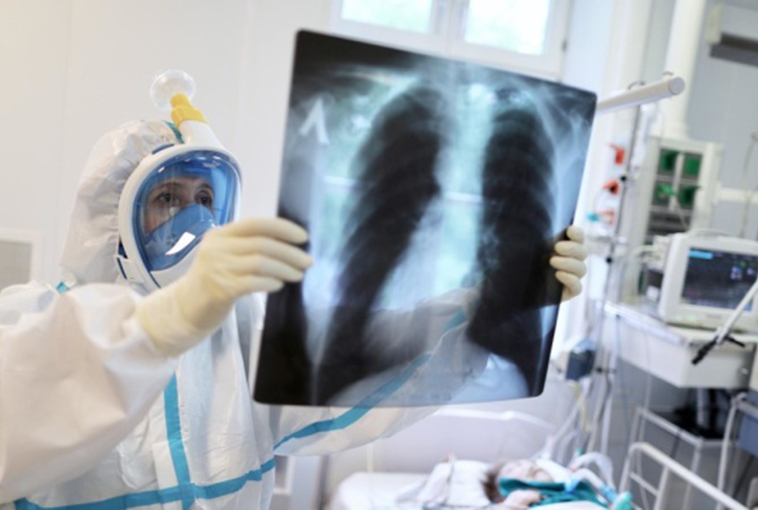 НПЗП не погіршують перебіг COVID‑19 у госпіталізованих пацієнтів