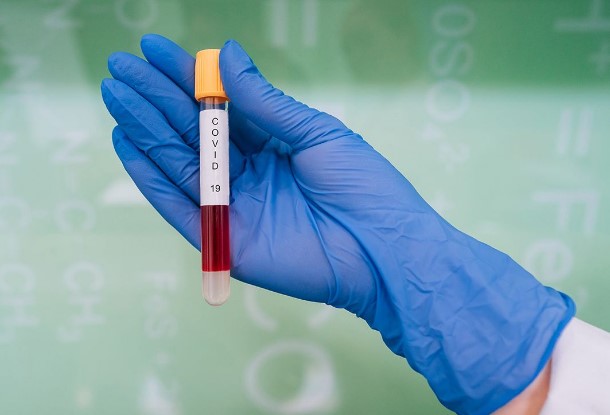 Компанія AstraZeneca планує отримати дозвіл на екстрене використання комбінації антитіл тривалої дії для профілактики симптоматичного COVID-19