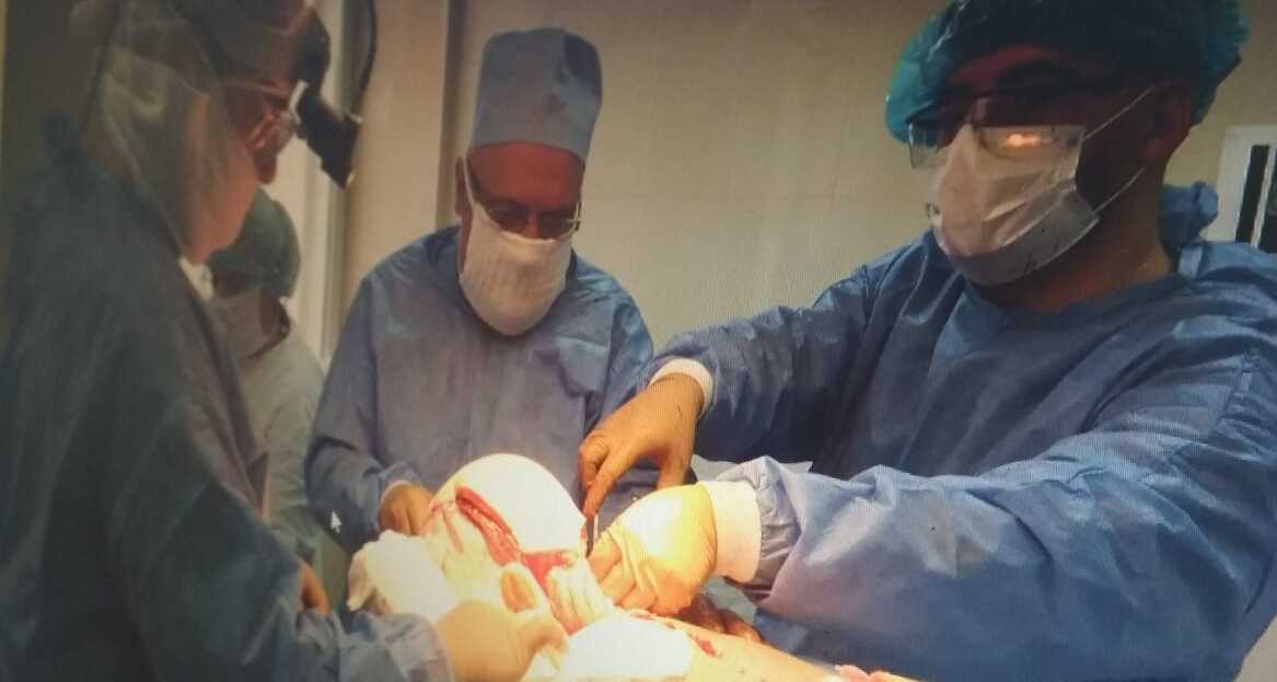 Київські лікарі видалили злоякісну пухлину, яка уражала значну ділянку шкіри голови пацієнта