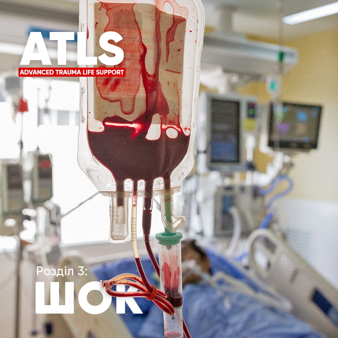 Доступний третій розділ 10 видання посібника ATLS