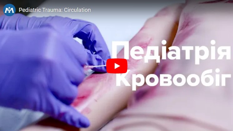 Догляд за дітьми з травмою: Особливості підтримки кровообігу.