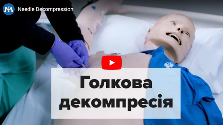 Алгоритм проведення голкової декомпресії у пацієнтів із напруженим пневмотораксом