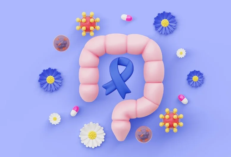 Алнодезертиб + іринотекан - інноваційна комбінація для лікування АТМ-дефіцитного метастатичного колоректального раку