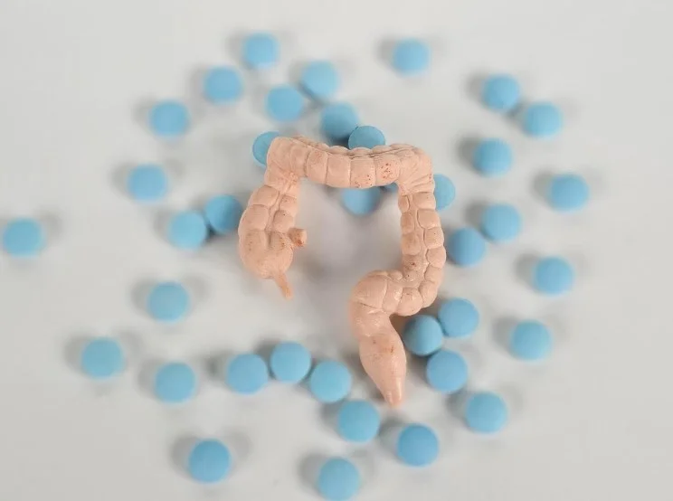 Кому потрібен целекоксиб: роль ctDNA у профілактиці рецидиву колоректального раку