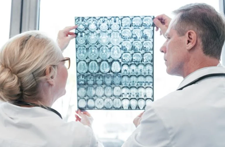 Оновлені рекомендації з ведення пацієнтів із черепно-мозковою травмою: фокус на довготривалій реабілітації