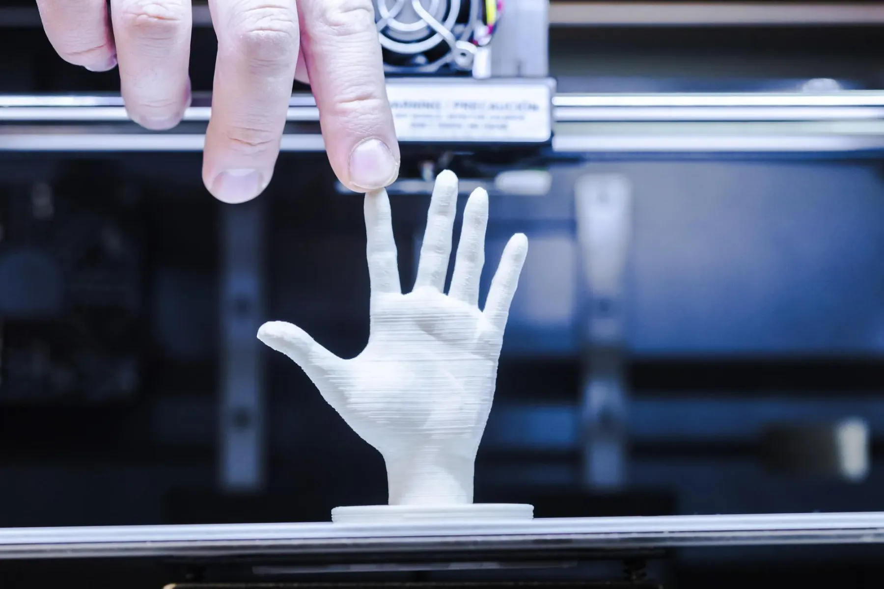 Поєднання 3D-візуалізації та друку допомогло першому пацієнту із Британії реконструювати обличчя