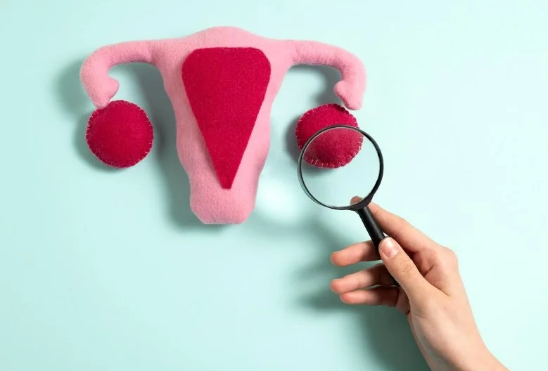 СПКЯ під мікроскопом: чотири фенотипи - чотири стратегії екстракорпорального запліднення