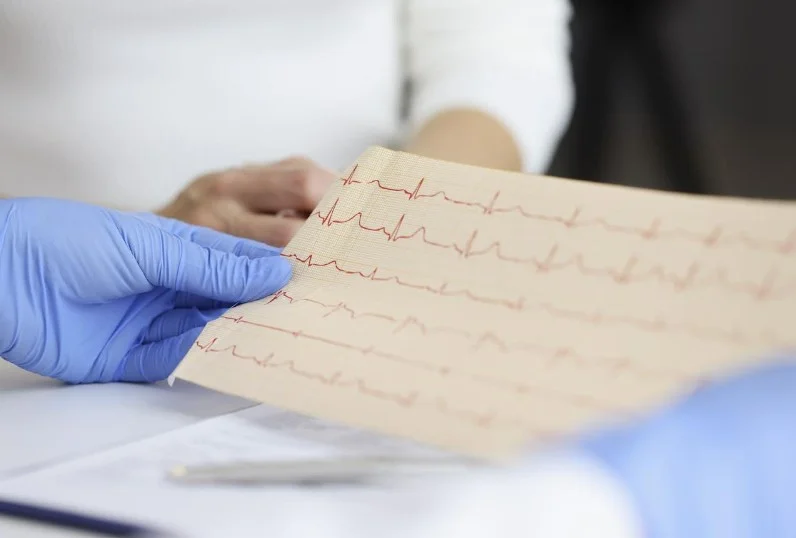 Штучний інтелект і ЕКГ: комбінований шлях до діагностики мікросудинної ішемії серця