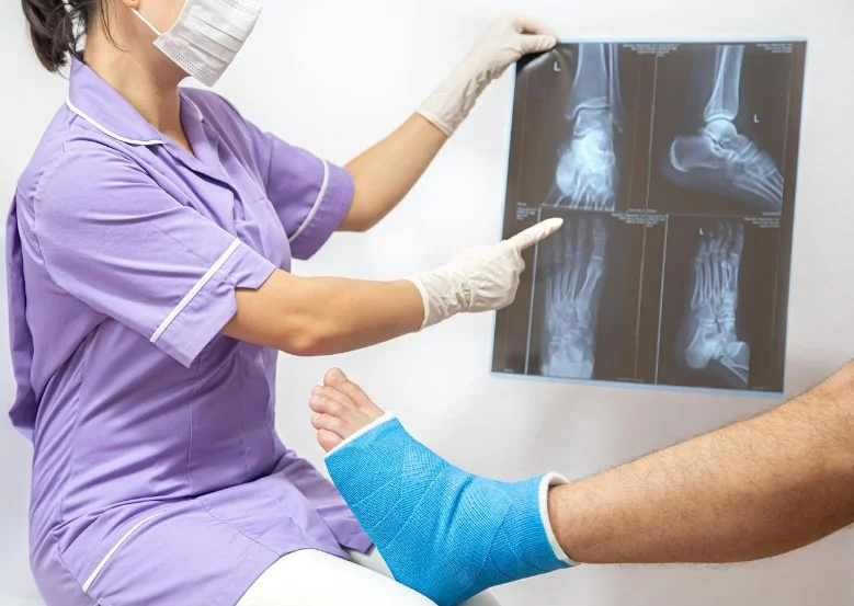 Гіпс замість скальпеля - переосмислення тактики лікування переломів надп'ятково-гомілкового суглоба