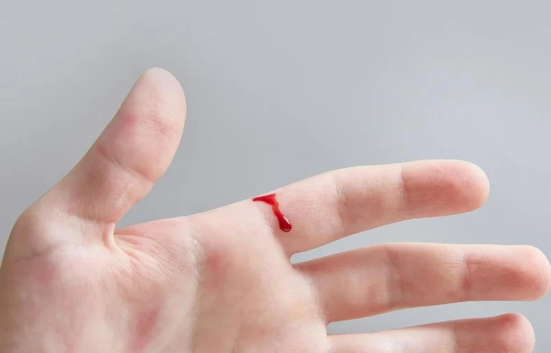 Порошковий гемостатик нового покоління: клінічні перспективи йонно-індукованої гелеутворювальної системи