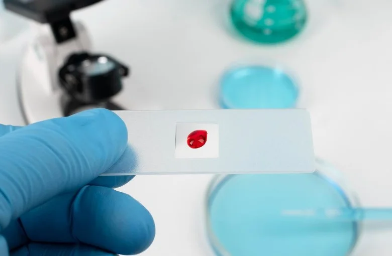 Чи завжди вищі показники гемоглобіну означають переваги для здоров'я? Останні дані про кардіометаболічні ризики