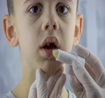 Ксеростомія в практиці інтерніста: що може за нею ховатися?