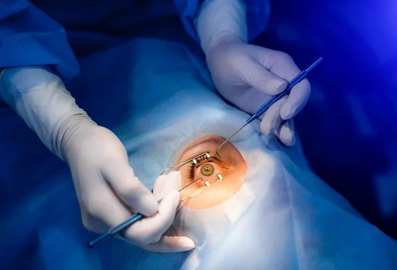 miDOC – інтраопераційна технологія, що забезпечує контроль відтоку рідини під час офтальмологічних операцій