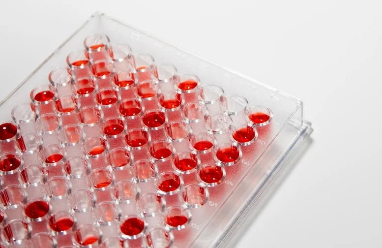 МОЗ України стандартизувало трансплантацію гемопоетичних стовбурових клітин