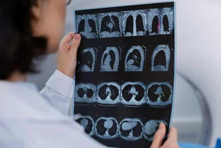 Настанова ACC/AHA пропонує змінену систематизацію та покращує маршрутизацію пацієнтів із ТЕЛА