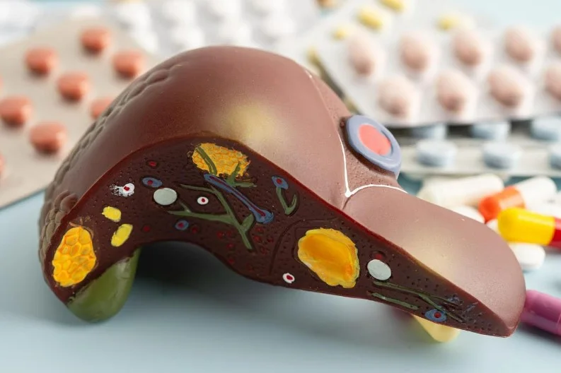 Оновлені настанови AGA: фокус на ранній скринінг та стратифікацію ризиків гепатоцелюлярної карциноми