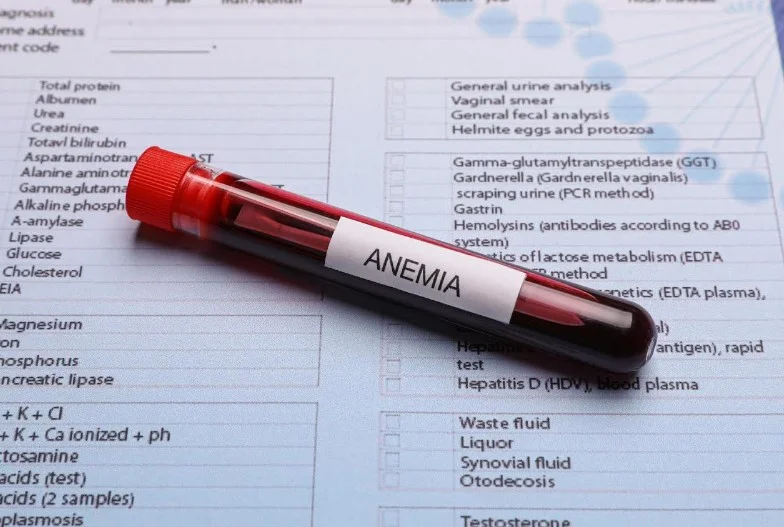 Останні рекомендації ASH у веденні тяжкої набутої апластичної анемії